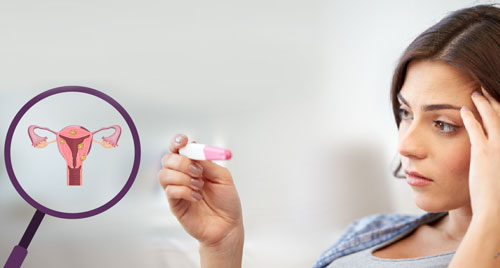 Infertility Treatments