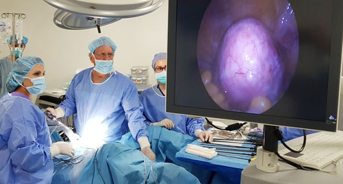 Laparoscopic Myomectomy